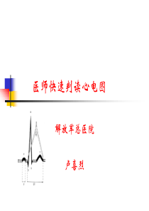 医生快速判读心电图