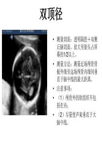 产科超声标准切面25张图