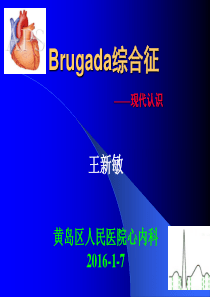 Brugada综合征