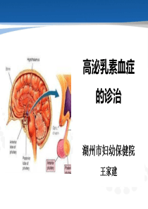 高泌乳素血症治疗