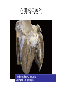 重庆医科大学 人体显微形态学实验(病理切片复习)