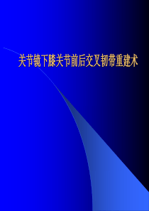 关节镜下膝前后交叉韧带重建术