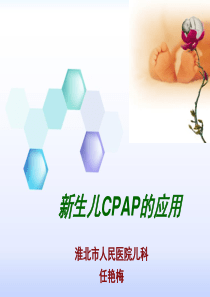 新生儿CPAP的临床应用