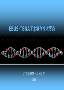 EBUS-TBNA手术操作要点