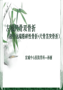 骨科护理查房桡骨骨折