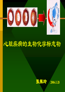 心脏疾病的生物化学标志物