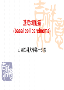 基底细胞癌