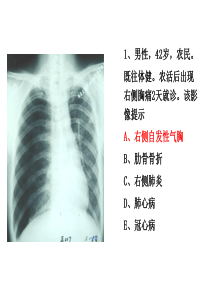 住院医师规陪出科考试辅助检查4