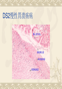 病理学实验切片复习要点3