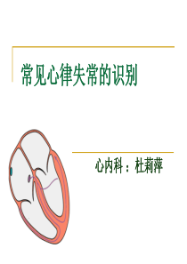 常见心律失常 .ppt