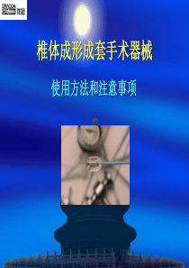 椎体成形