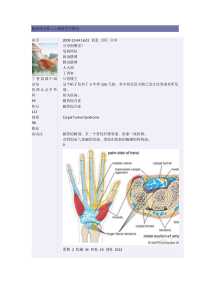 讲解腕管综合征