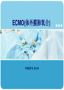 ECMO(体外膜肺氧合)