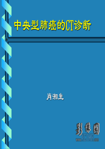 中央型肺癌的CT诊断详解