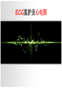 月讲课ECG监护及心电图