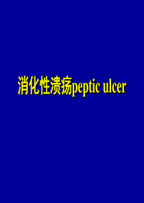 消化性溃疡ppt