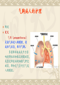 气胸病人的护理