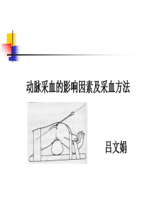 肺动脉高压  庄敏