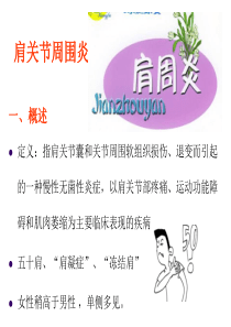 肩周炎的治疗方法