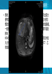 中国结直肠癌肝转移诊断和综合治疗指南