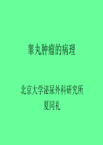 睾丸肿瘤的病理