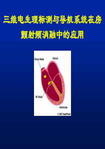 三维电生理标测与导航系统在房颤射频消融中的应用