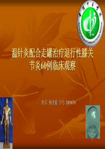 温针灸配合走罐治疗退行性膝关节