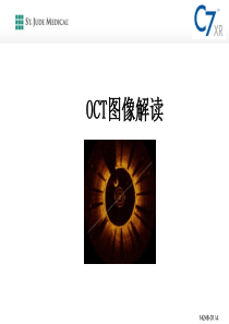 OCT图像解读