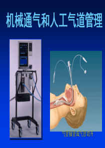 机械通气和人工气道管理