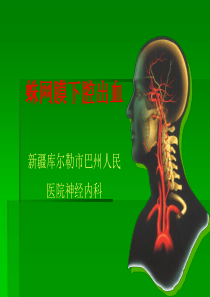 蛛网膜下腔出血