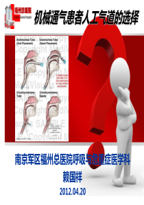 机械通气患者人工气道的选择