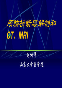 颅脑横断层解剖和CT及MRI