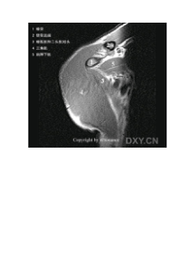 肩关节磁共振解剖图谱