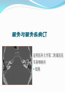 颞骨CT与疾病