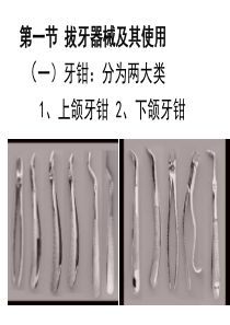 拔牙的过程如何