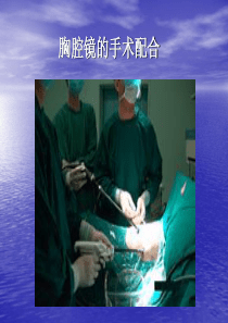 胸腔镜肺大疱切除