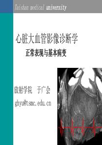 循环系统影像诊断学ppt文档1