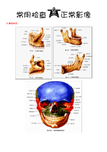 85口腔 颌面影像 诊断