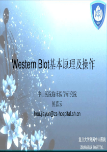 Western-Blot基本原理及操作