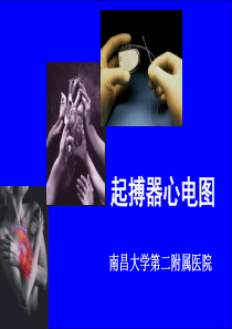 常见起搏器心电图解读