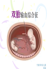 双胎输血综合症-PPT课件