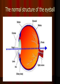 Diabetic-retinopathy糖尿病视网膜病变英文