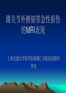 96踝关节外侧韧带急性损伤的MRI表现