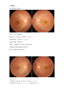 正常眼底及常见异常眼底图分析(眼底照相)