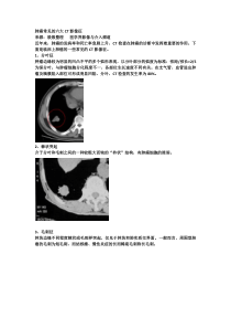 肺癌常见的六大CT影像征