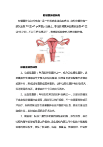 女性卵巢囊肿的种类