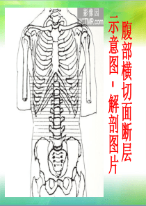 腹部断层解剖和断层CT(精品)