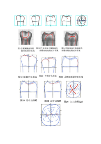 雕刻牙齿外形图