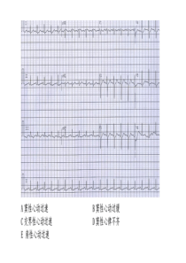 心电图练习题(带图有答案)