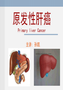 原发性肝癌